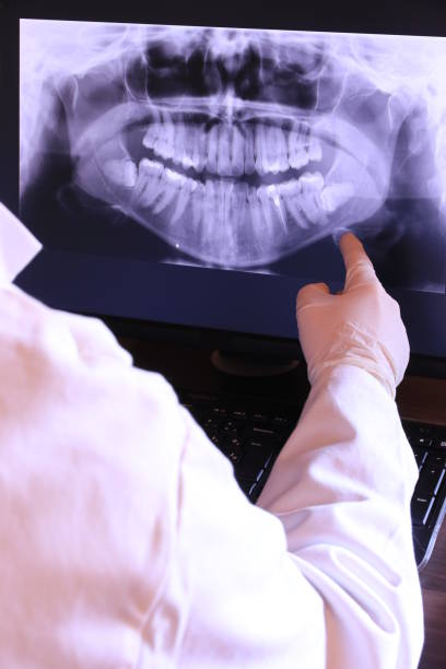 Best Emergency Broken Tooth Repair in Weston, FL